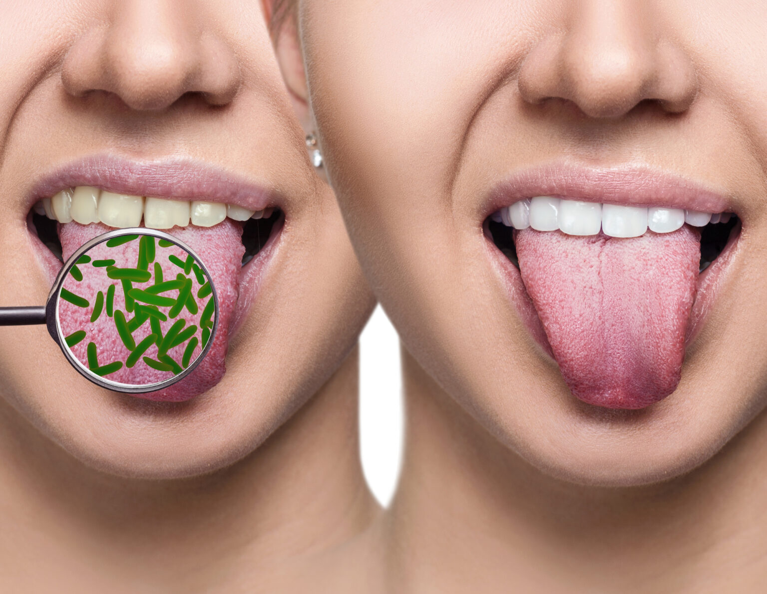 日進市、名古屋市、長久手市、東郷町、みよし市の歯科診療なら「歯科オーラルクリニック エクラ」